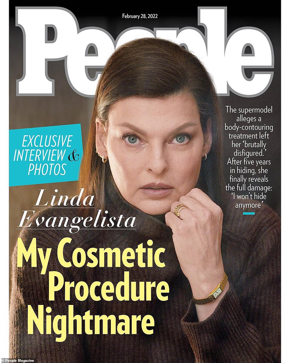 Devastating: Supermodel Linda Evangelista posed for her first photo shoot after revealing she was left 'permanently deformed' by the rare side effects of a cosmetic procedure she underwent six years ago