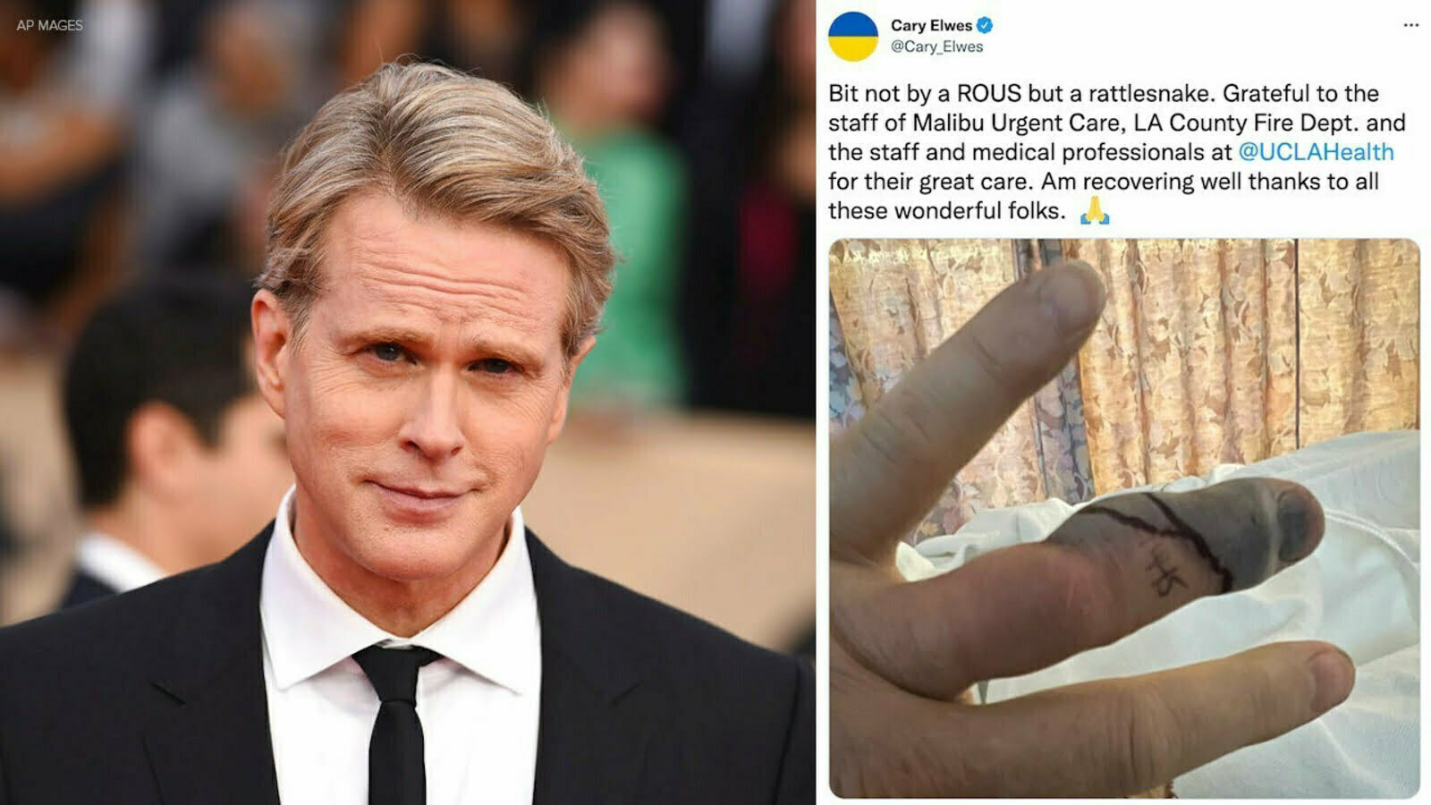 The Princess Bride actor Cary Elwes is recovering after being