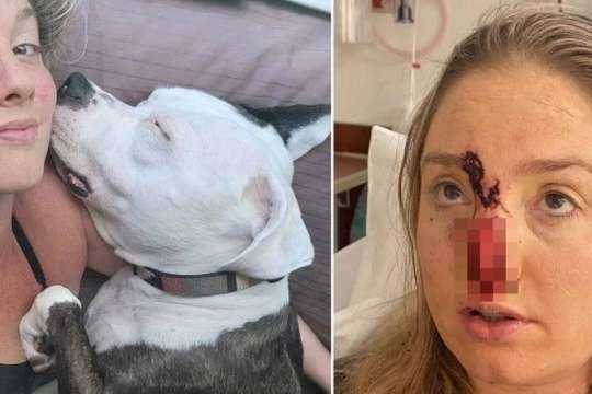 Woman attacked by dog ​​after being irritated by plaque light