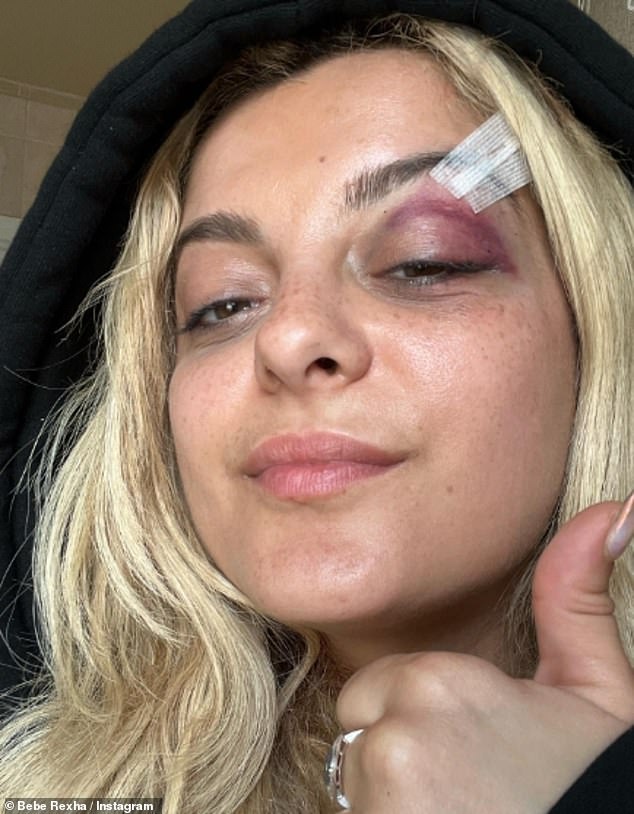 Stars attacked after Bebe Rexha and Ava Max attacked at