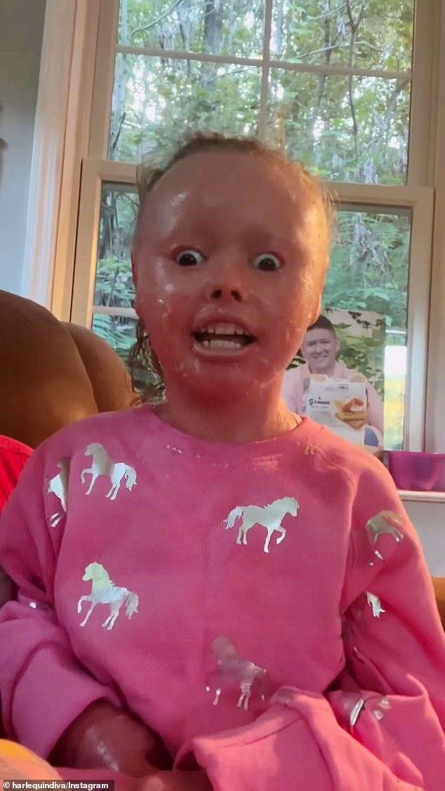 The Foundation for Ichthyosis and Related Skin Types sent a letter to Netflix but had not received a response as of Friday.  Members of the ichthyosis community came together to make a video expressing their anger