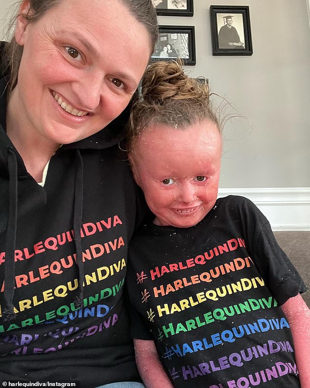 Members of the Harlequin Ichthyosis community were rightly outraged by the insensitive use of videos depicting someone with a rare disease in a $4.8 million film for entertainment purposes